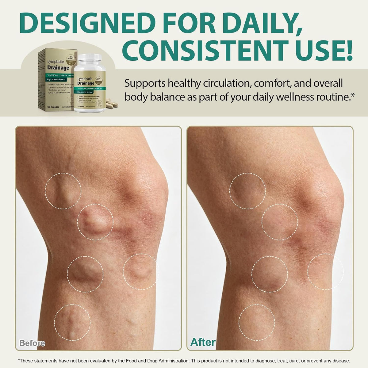 Lymphatic Drainage Supplements, Lymphatic Drainage Capsules for Immune