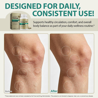 Lymphatic Drainage Supplements, Lymphatic Drainage Capsules for Immune